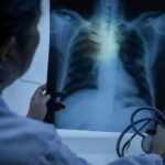 Answering FAQs on Tuberculosis (TB): A Resource for Providers